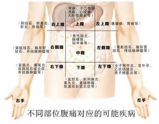 62a709f3a52e8.png