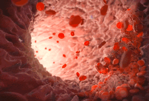 62a70b552c571.gif