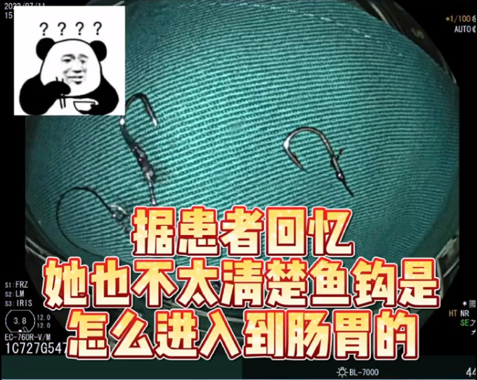 62da1150d2493.png